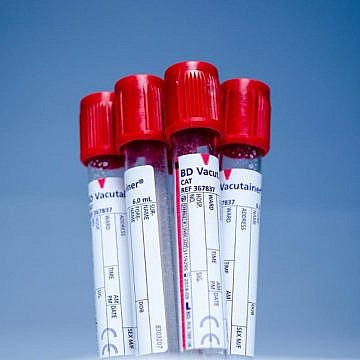 Savanoriškai aukoja savo kraują ir taip gelbsti gyvybes