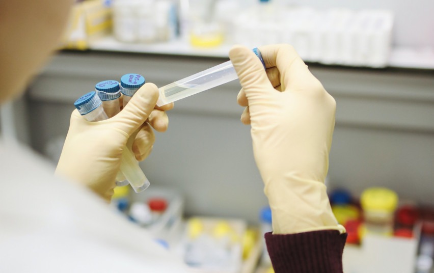 Patvirtintas aštuntas koronaviruso infekcijos atvejis Skuodo rajone