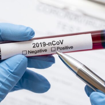 Skuodo rajone patvirtintas 9-asis koronaviruso atvejis