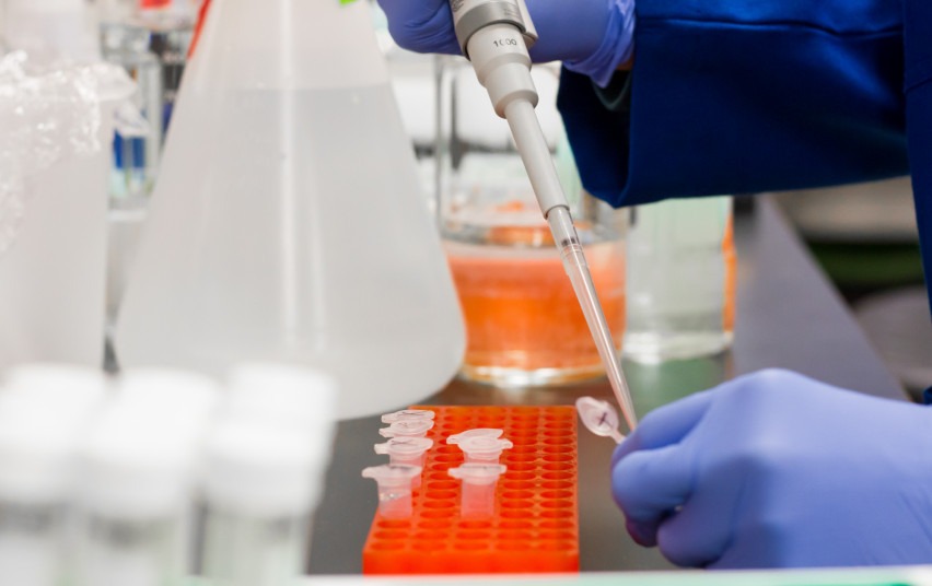 COVID-19 tyrimų rūšys: kada kokio tyrimo reikalaujama