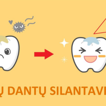 Featured image for article: Priminimas tėvams: vaikų dantų silantavimas – nemokama profilaktikos paslauga!